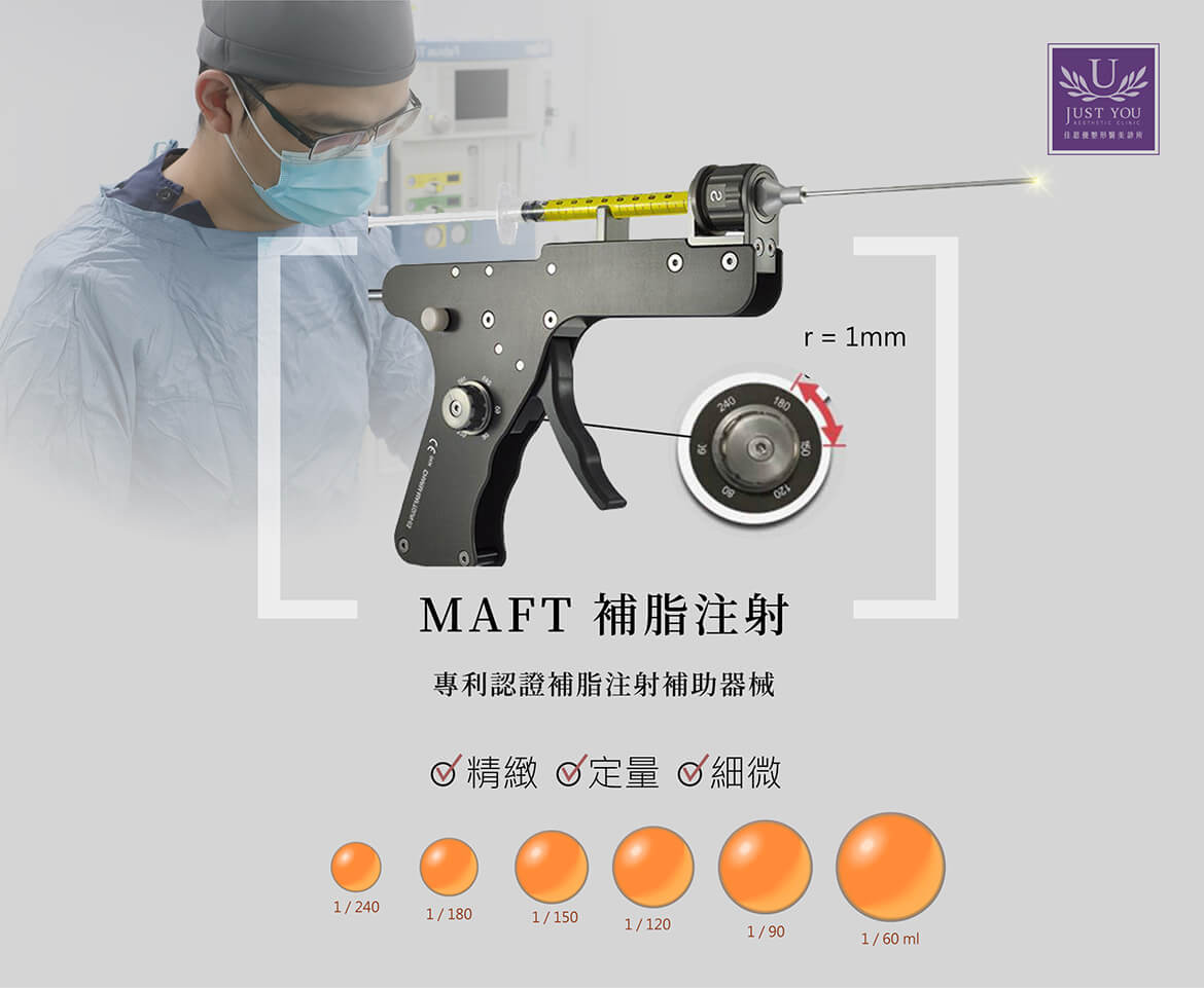 自體脂肪隆乳MAFT補脂槍