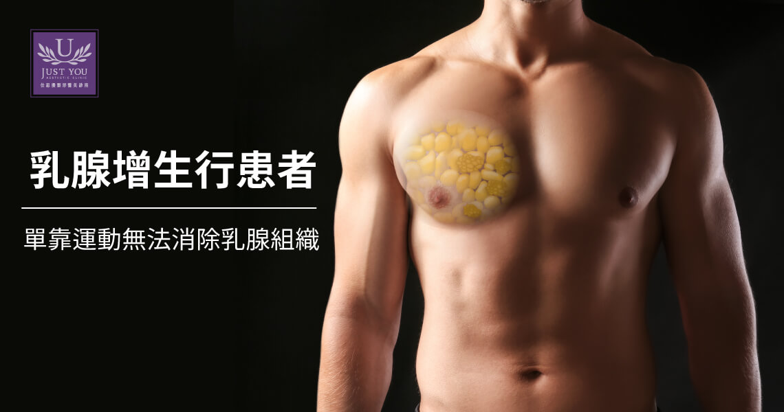 乳腺增生行患者單靠運動無法解決男性女乳症
