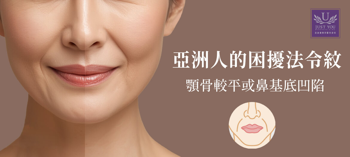 亞洲人的困擾法令紋