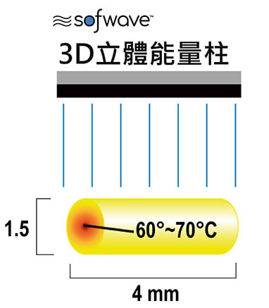 Sofwave 索夫波专利1：SUPERBTM 3D 立体能量柱