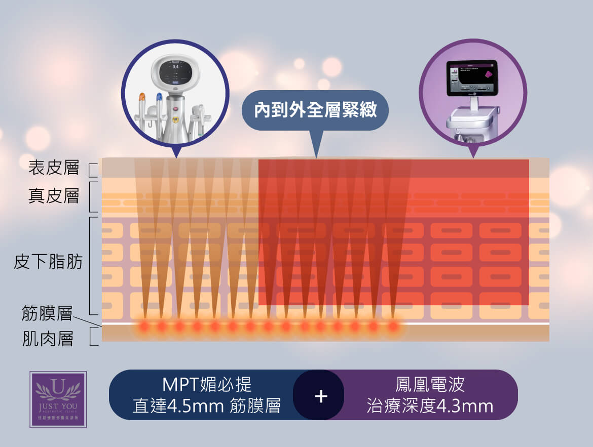 Thermage FLX凤凰电波拉提」与「MPT第四代媚必提音波拉提」交联式网状电音双波二合一治疗，此方式比一般传统打法更密集，一次便可从内到外全层紧致。