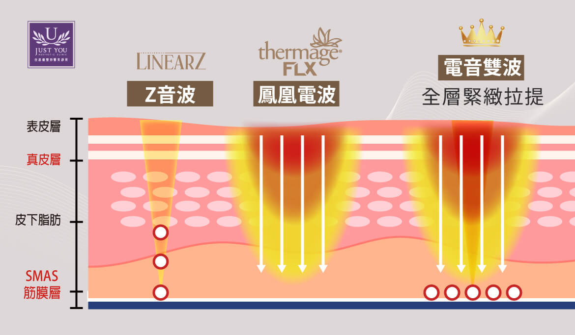 「第四代 Thermage FLX凤凰电波拉提」与「第五代Linear Z线性音波」交联式网状电音双波二合一治疗