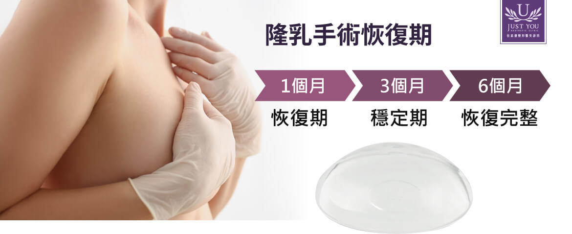 盈波隆乳IMPLEO™ 恢復期