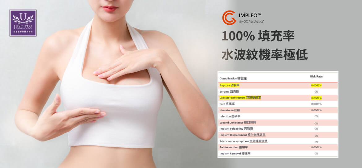 盈波隆乳IMPLEO™ - 100%填充率，低水波紋