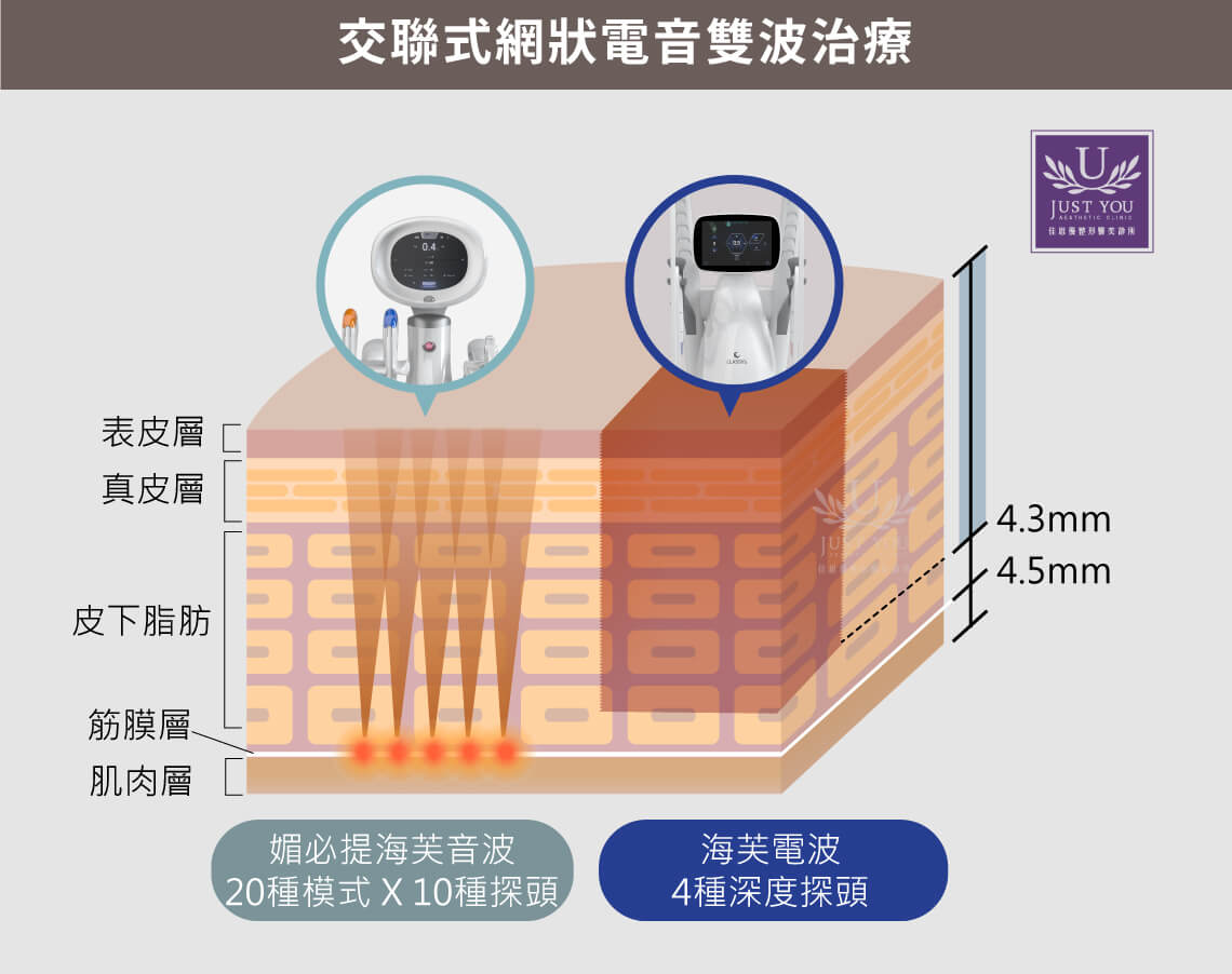 Volnewmer海芙電波與MPT媚必提海芙音波交聯打法