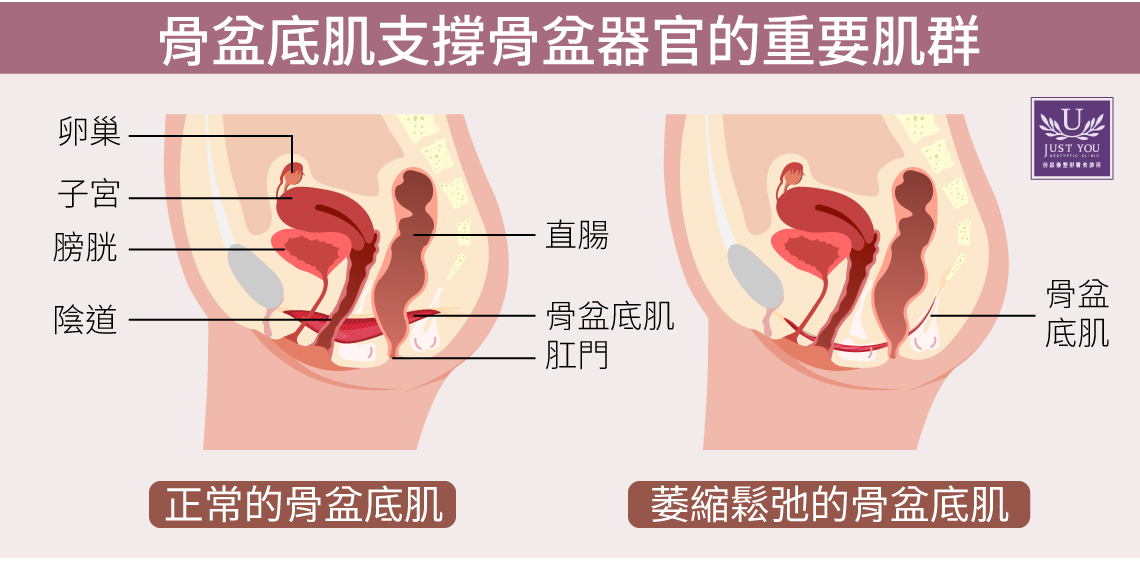 盆底肌的角色與常見困擾