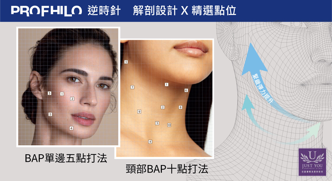 Profhilo 逆時針採用BPA獨特五點定位注射法，不僅大幅提升療程的舒適度