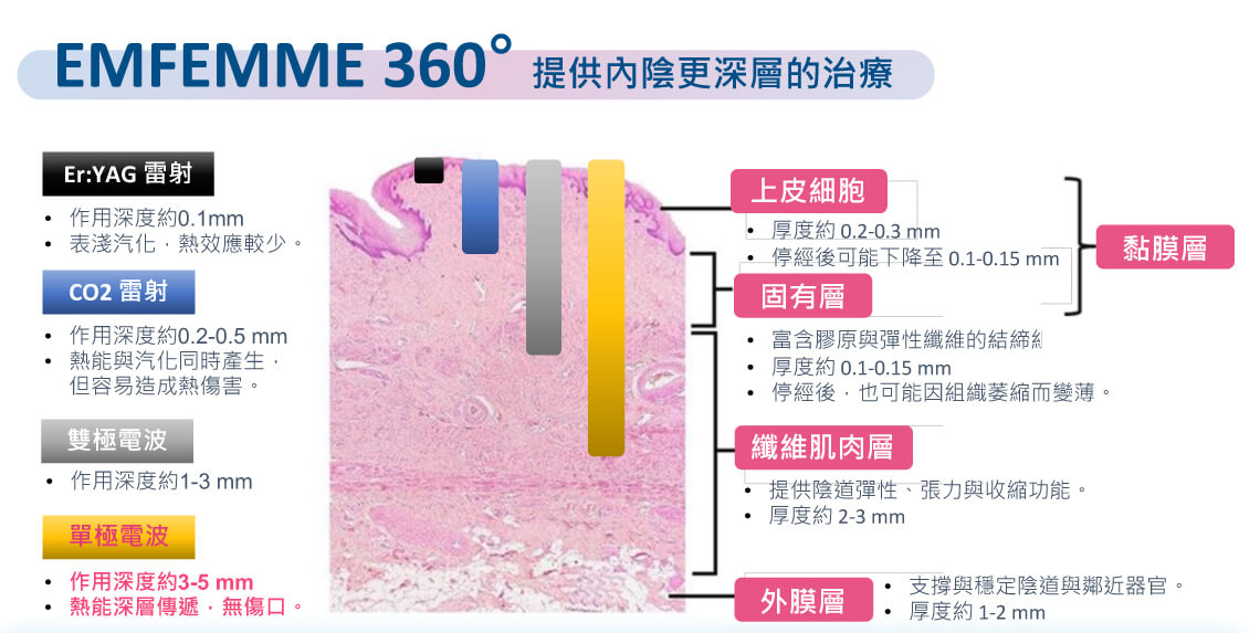 闺蜜电波（EMFEMME）-提供内阴道更深的治疗