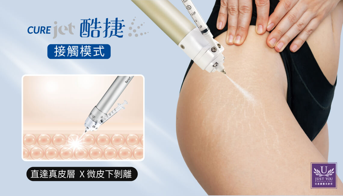 酷捷搭配接觸模式,精準導入真皮層