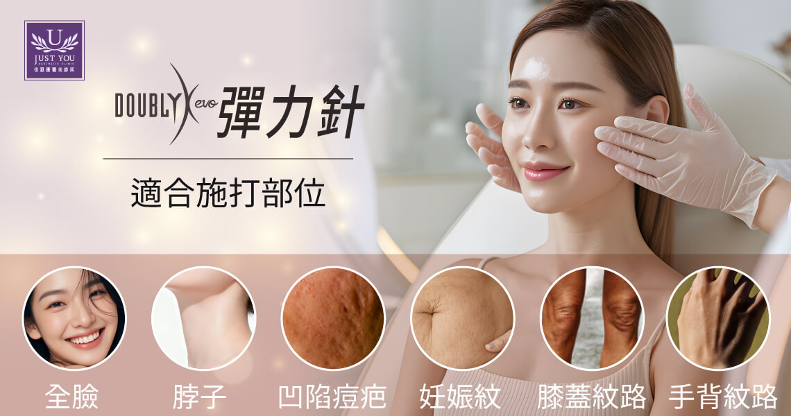 彈力針的適應症非常廣泛。除了全臉顴骨、臉頰外，它對於頸部紋路 (Neck lines) 的改善效果卓越 。此外，針對身體的淺層皮膚創傷後疤痕，如青春痘疤痕、妊娠紋等，甚至膝蓋紋路、私密皺褶都可以淡化喔！