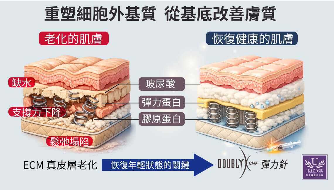 彈力針注射後則可以補充高品質的棉花（深層保濕），更重要的是它能喚醒沉睡的纖維母細胞。透過誘發，讓細胞工廠重新開工，主動修復斷裂的鋼骨（膠原蛋白）與老化的記憶泡棉（彈力蛋白），找回肌膚年輕時的支撐力與回彈性。