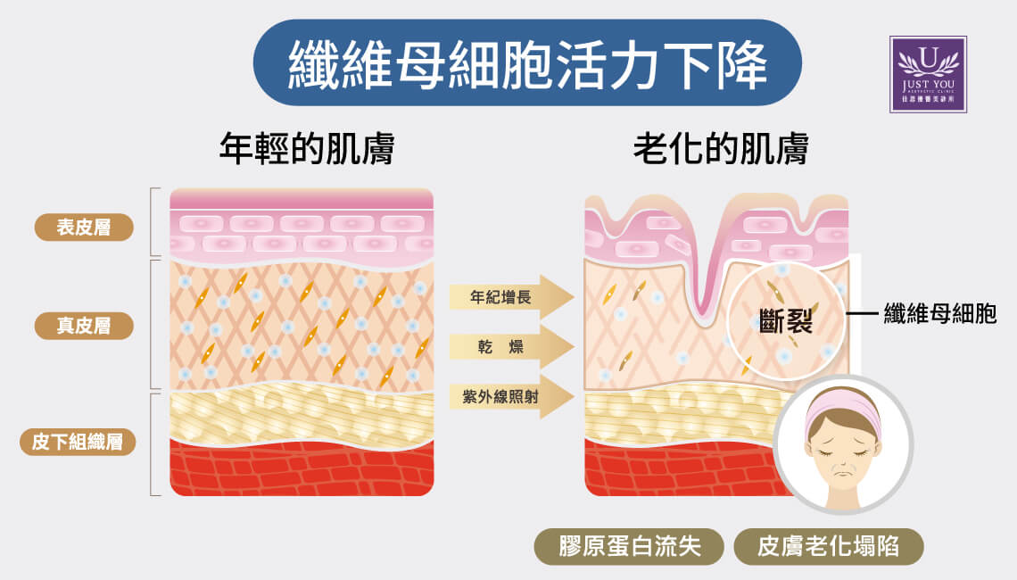 纤维母细胞位于真皮层，是维持胶原蛋白、弹性蛋白与细胞外基质等结构性成分的重要细胞，而这些成分共同构成皮肤的主要结缔组织。一旦纤维母细胞功能下降，真皮层的支撑便容易松动，皱纹、弹性流失造成的凹陷与皮肤粗糙等老化现象也会逐渐变得明显。