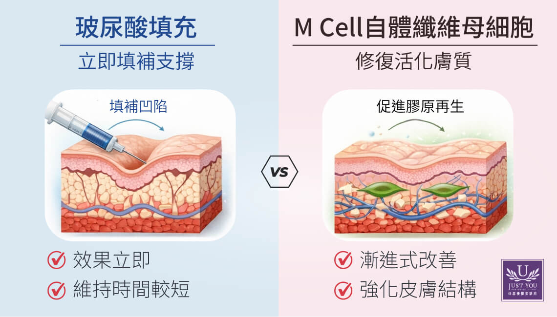 M Cell自体纤维母细胞与传统填充物（玻尿酸）的差异：玻尿酸的主要作用是立即填补皮下体积与改善外观轮廓，适合需要立即改善凹陷或塑形的人；但其维持时间较短，原理也属外加支撑。M Cell自体纤维母细胞治疗的操作方向则不同