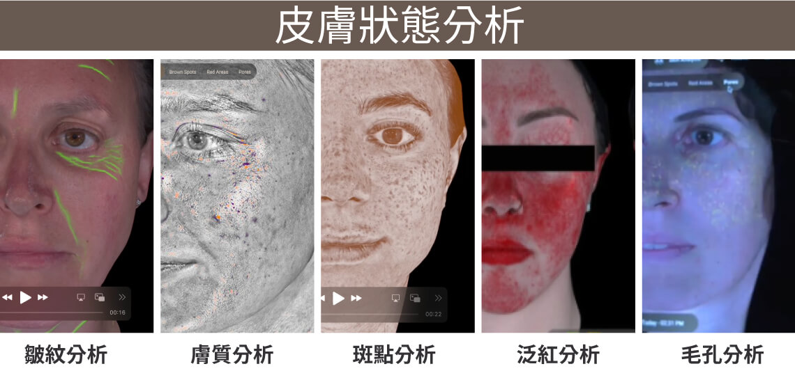 AURA 歐若拉 3D魔鏡也能輔助觀察毛孔、皺紋、膚色不均、斑點、泛紅與膚質紋理等問題