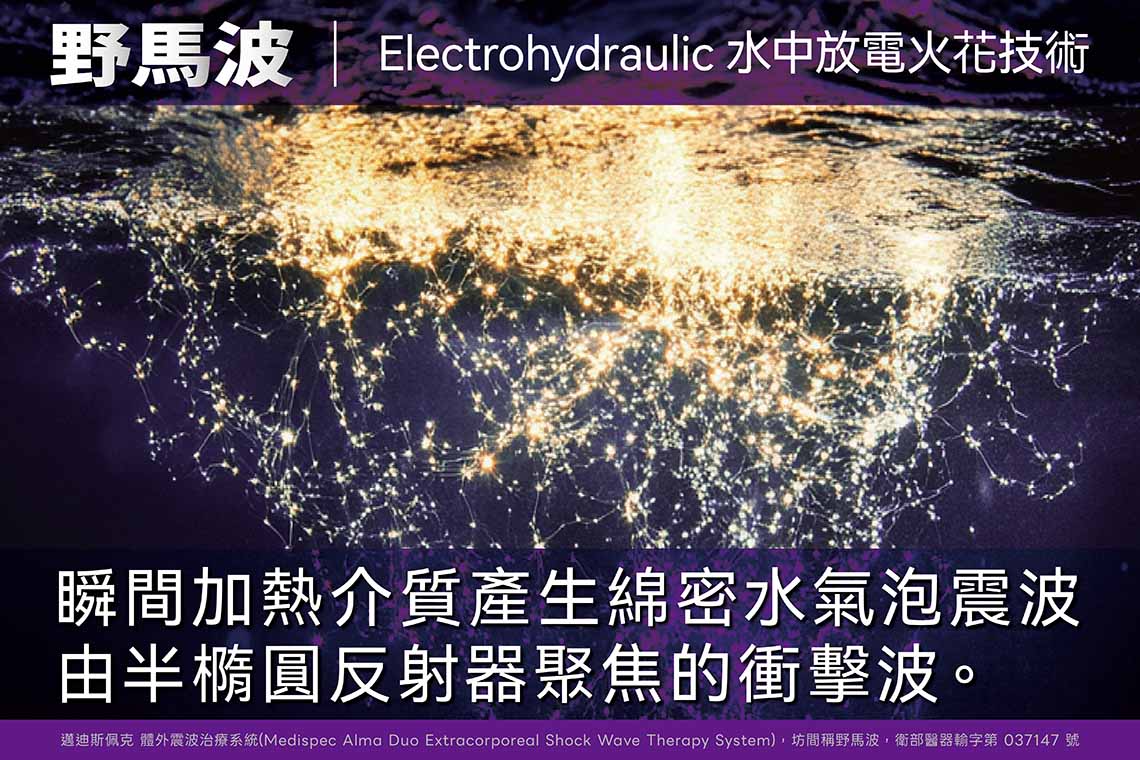 Alma Duo野馬波：專利水電式技術的科學原理。運用前衛的超跑水震波概念，讓療程過程非侵入且舒適無負擔。透過直達 6.5 公分深處的高密度震波，搭配 40 微秒瞬間產生的高壓水氣泡空泡壓，能將修復能量精準穿透組織。 
