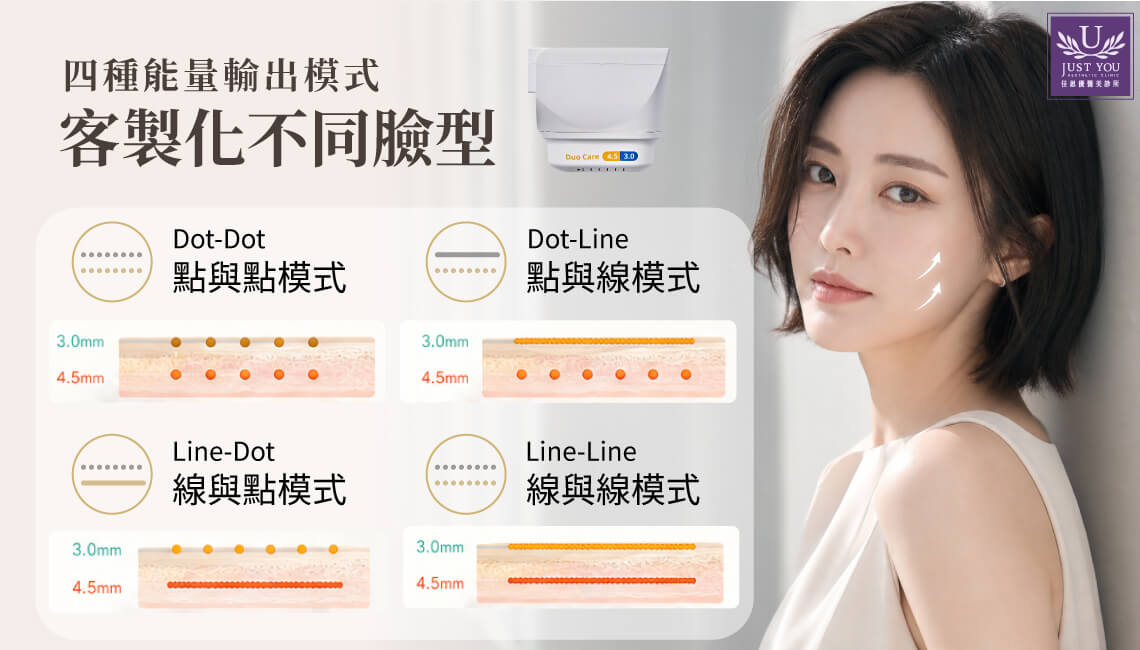 多泰音波的四种能量输出模式,客制化不同脸型 ➤ 1.点与点模式 2.线与线模式 3.点与线模式 4.线与点模式