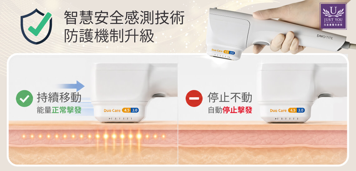 DUOTITE 多泰音波内建移动感知器。在疗程进行中,系统会实时侦测探头的移动状态,一旦感知到手握把静止未移动,仪器会瞬间自动停止能量击发。这项防护技术确保了能量的均匀分布,为患者提供了安心无虞的治疗环境。