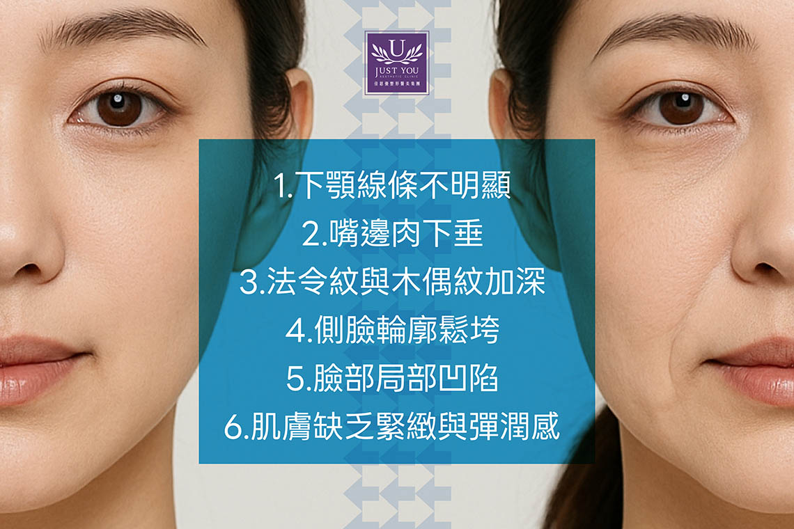 適合規劃HArmonyCa™媄神針療程的6種狀況:1. 下顎線條不明顯;2.嘴邊肉下垂;3.法令紋與木偶紋加深;4.側臉輪廓鬆垮;5.臉部局部凹陷;6.肌膚缺乏緊緻與彈潤感