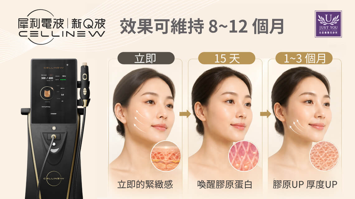 犀利电波多立即就会感受到效果，效果可以维持8~12个月左右