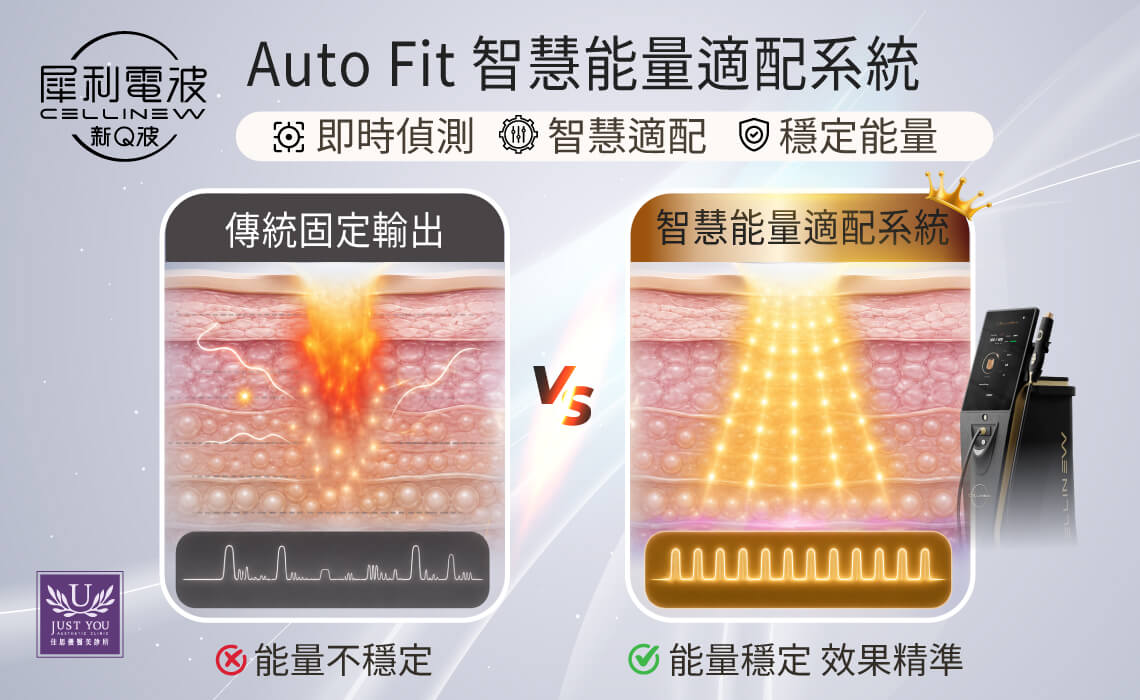 CELLINEW 犀利电波搭仔的 Auto Fit 智能能量适配系统：实时侦测、智慧适配、稳定能量