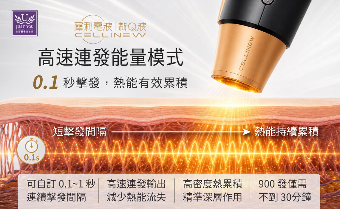 犀利电波提供高速连发能量模式：0.1秒击发，热能有效累积，完整 900 发的电波拉皮疗程，仅需不到 30分钟即可完成。 