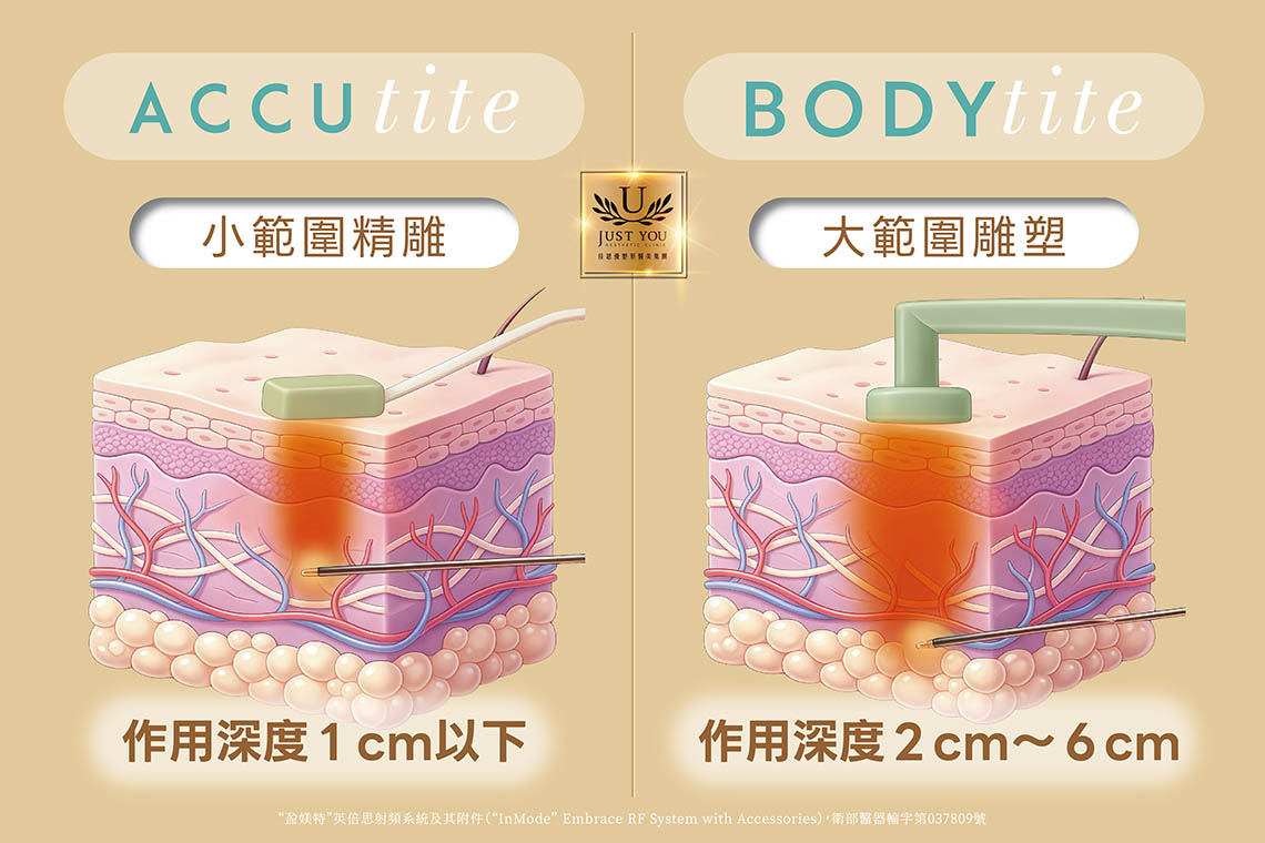 钛特离子夹可依治疗范围搭配 BodyTite 与 AccuTite 手把，无论是大面积腹部、臀部、大腿的肌肤紧实，或膝盖周围、手臂的局部细致雕塑，都能客制化打造利落的轮廓