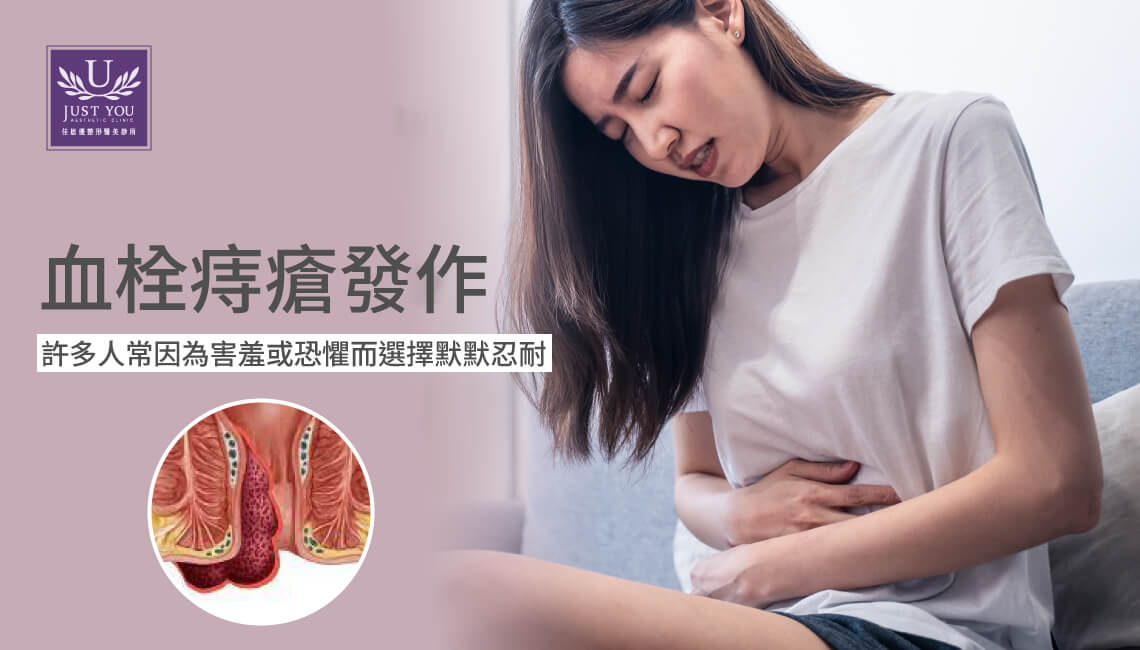 微創血栓痔瘡手術，許多人常因害羞恐懼默默忍耐