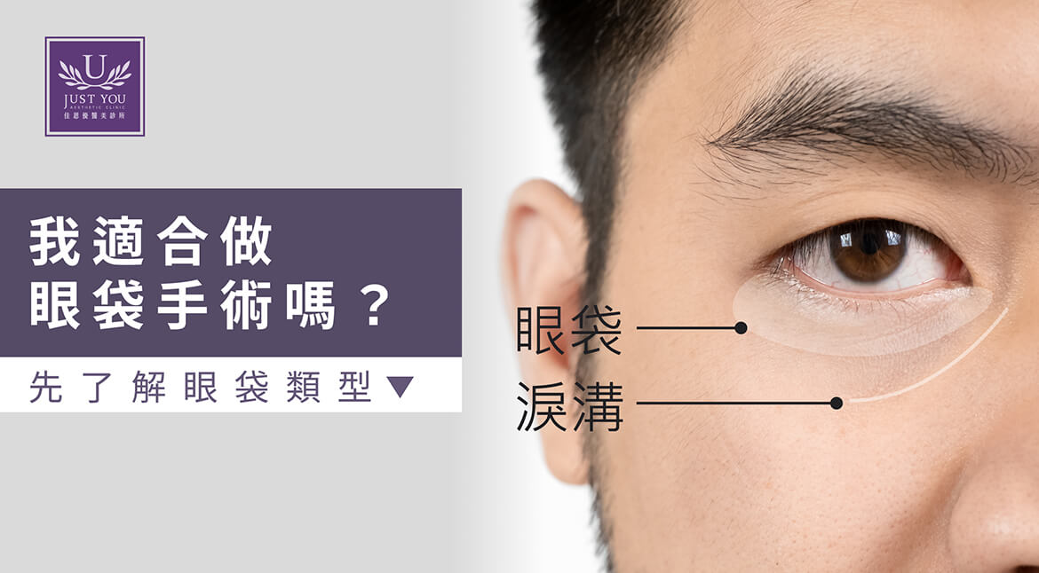 哪些適應症可以做眼袋手術？