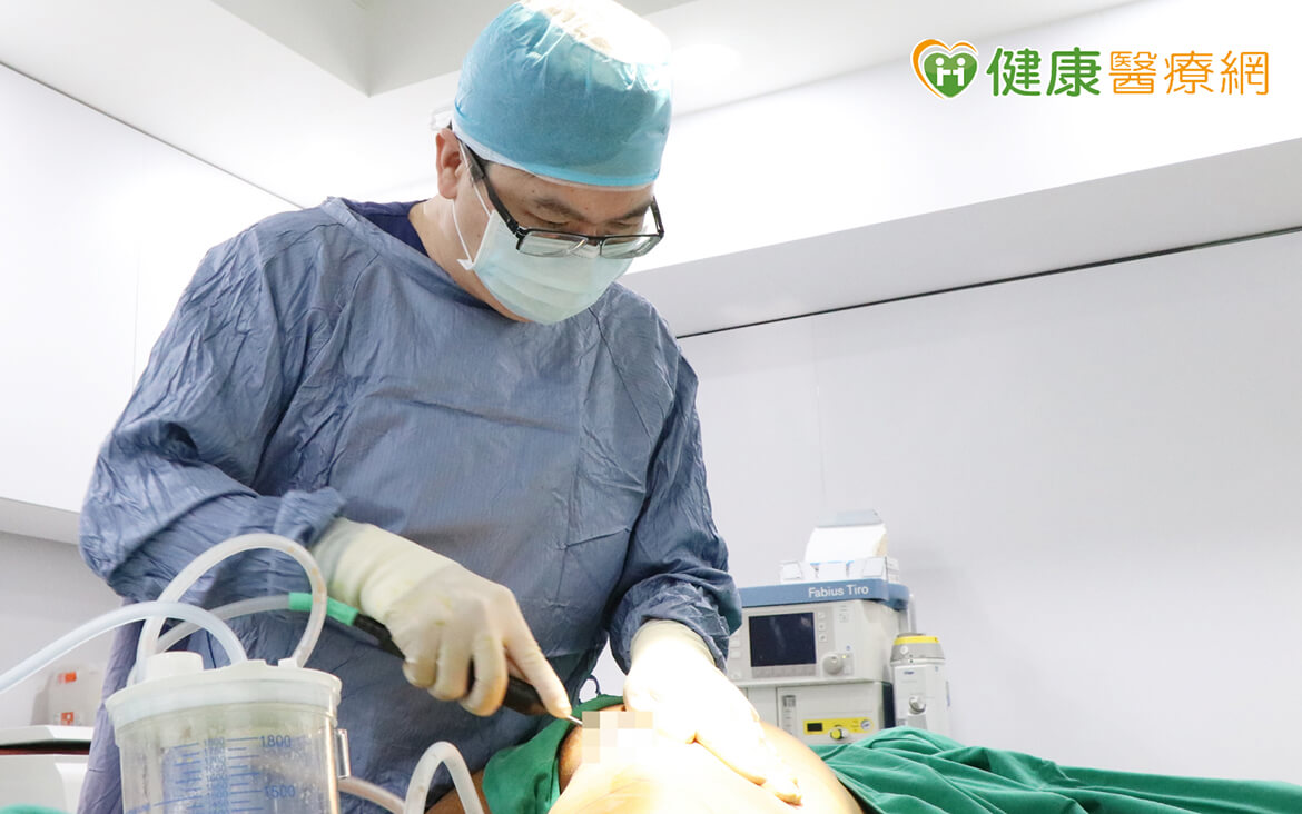佳思優醫美集團李兆翔醫師為VASER2.2二代威塑抽脂手術原廠認證講師