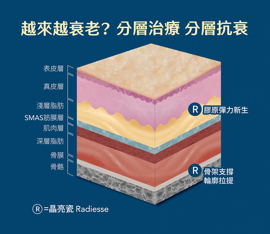 Radiesse晶亮瓷-分層治療分層抗衰