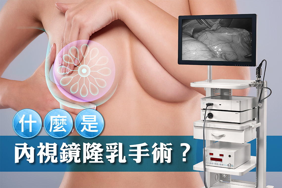 什么是内视镜隆乳手术？