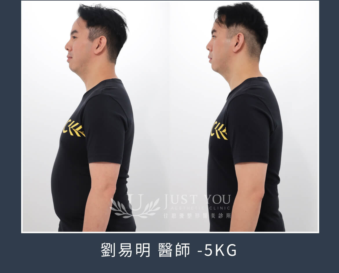 瘦瘦筆案例-劉醫師親自見證