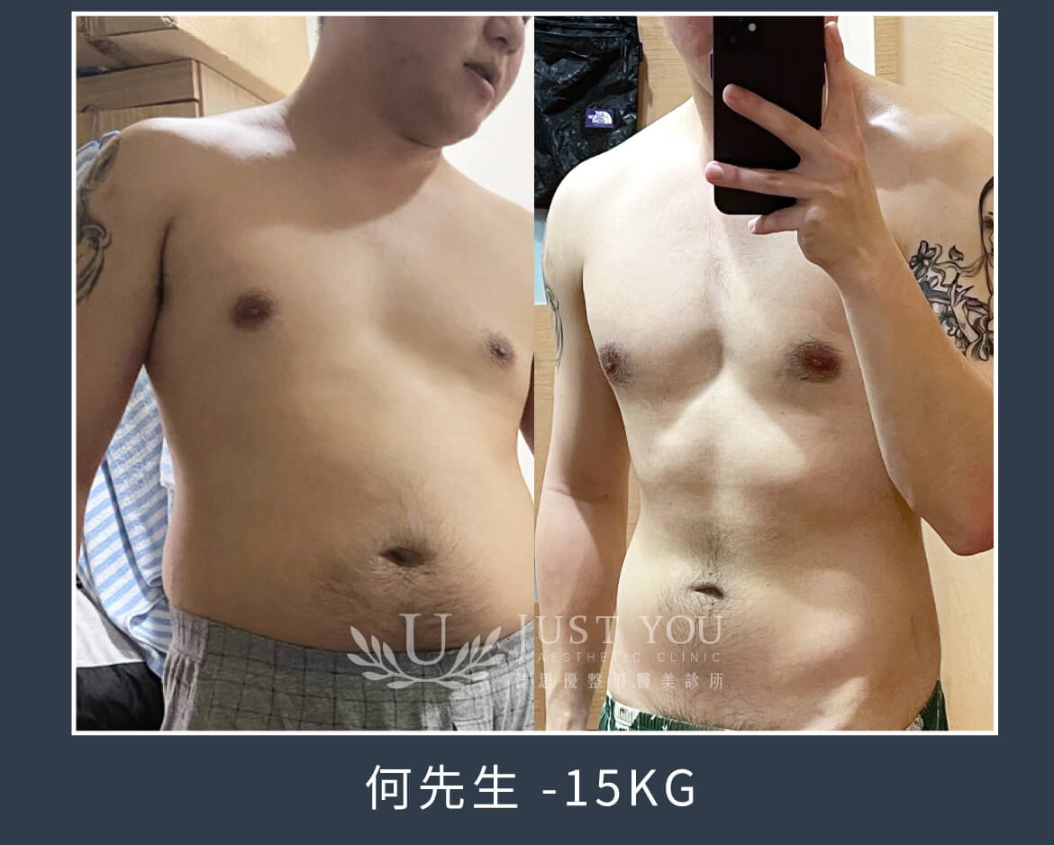 瘦瘦筆案例-何先生 -15kg