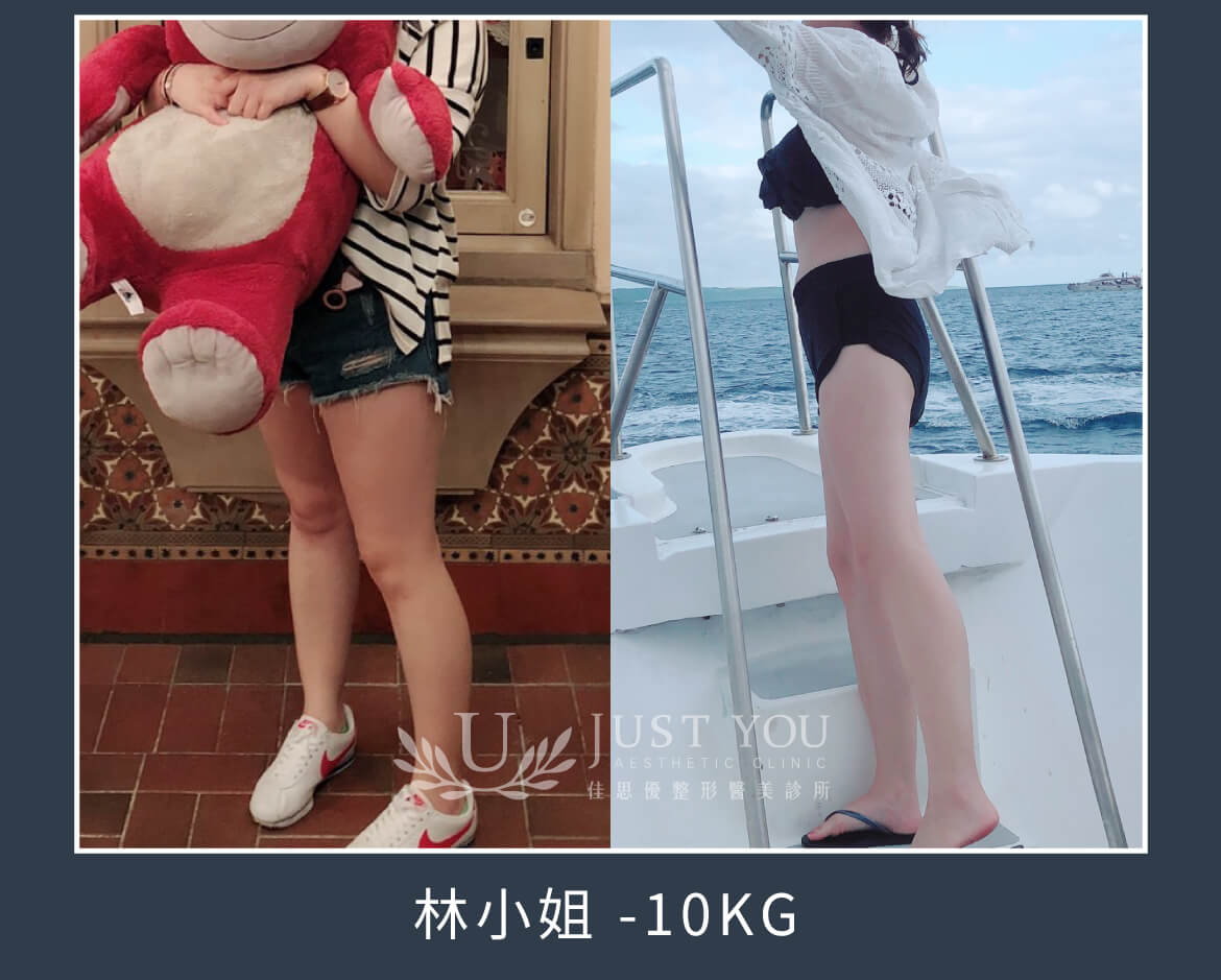瘦瘦筆案例-林小姐 -10KG