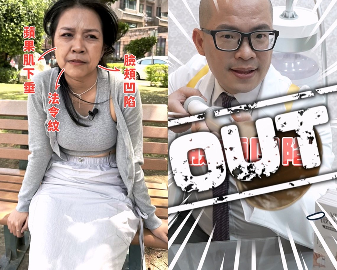 佳思优-苹果肌法令纹等问题用vivabella薇贝拉解决