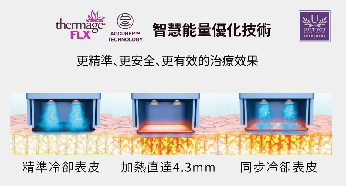 Thermage FLX 鳳凰電波採用全新 AccuREP™智慧能量優化技術