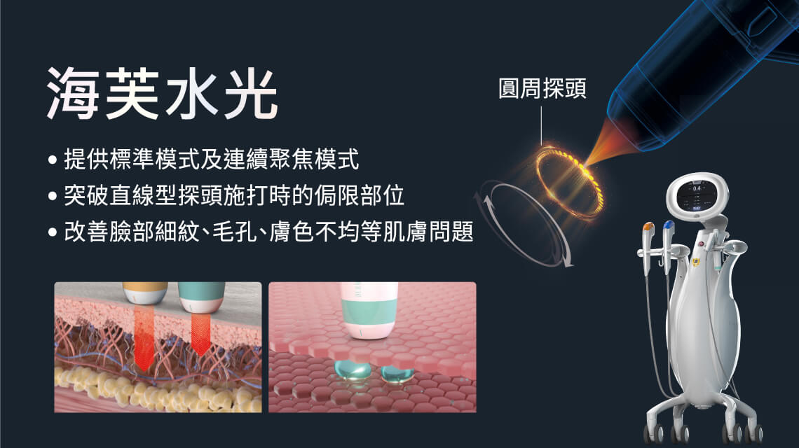音波水光是一种将高能聚焦超音波（HIFU）及专利圆周探头技术