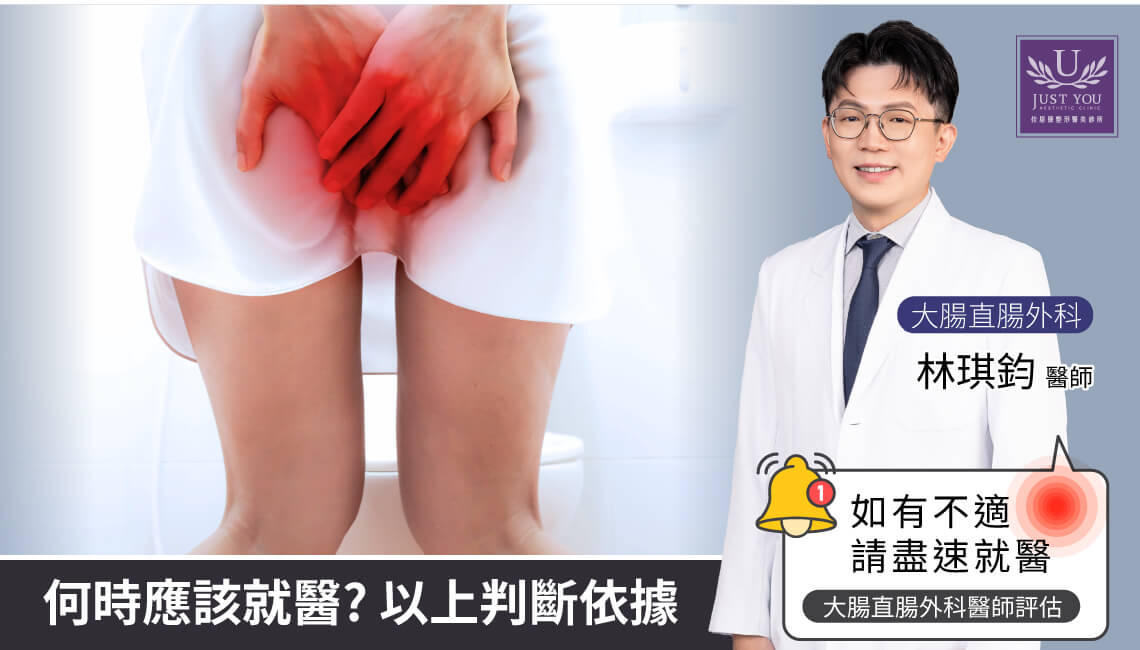 痔疮有什么治疗方式?何时应该就医