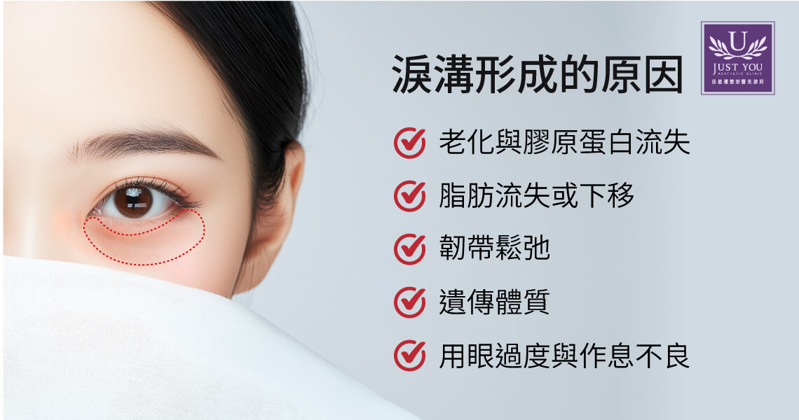 淚溝形成的原因