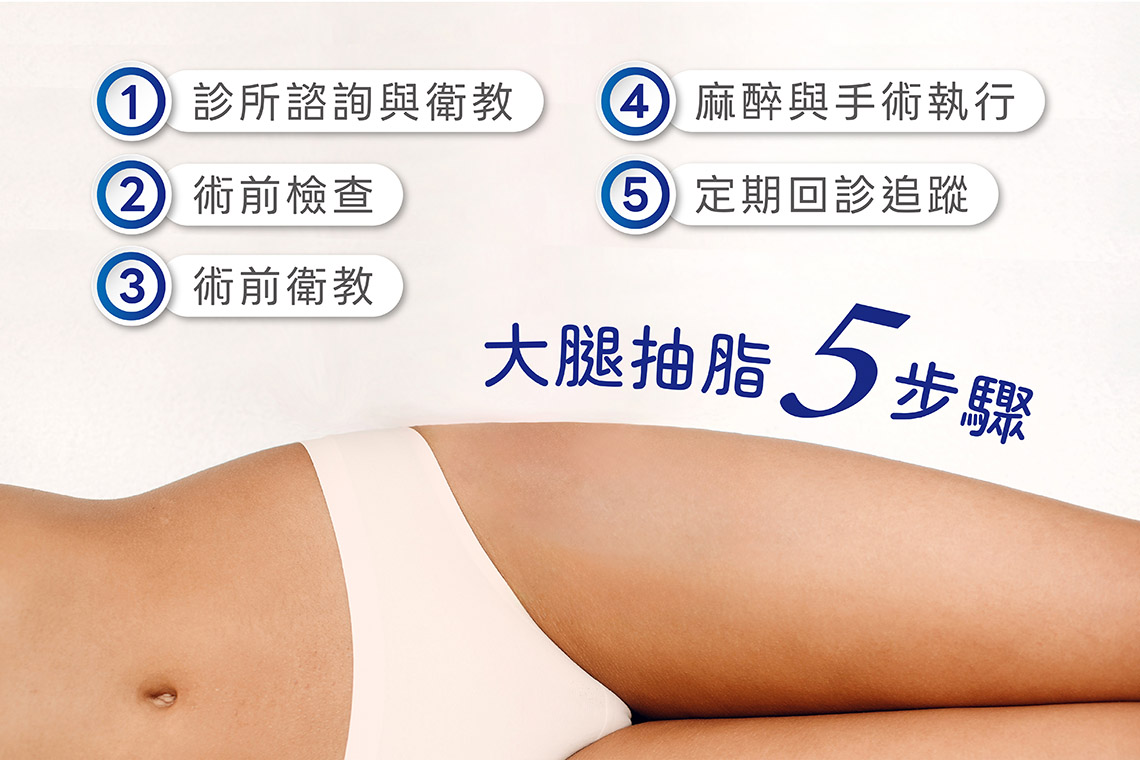 大腿抽脂手術流程為何？大腿抽脂 5 步驟分享