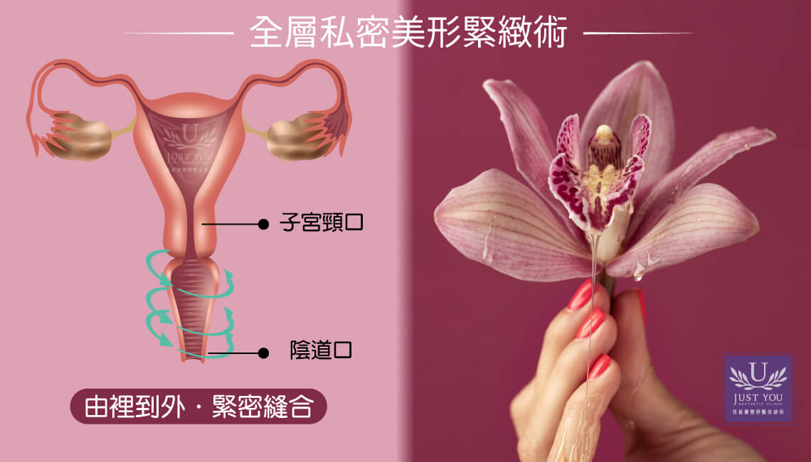 3.陰道緊實療程:從外到內的全面支撐