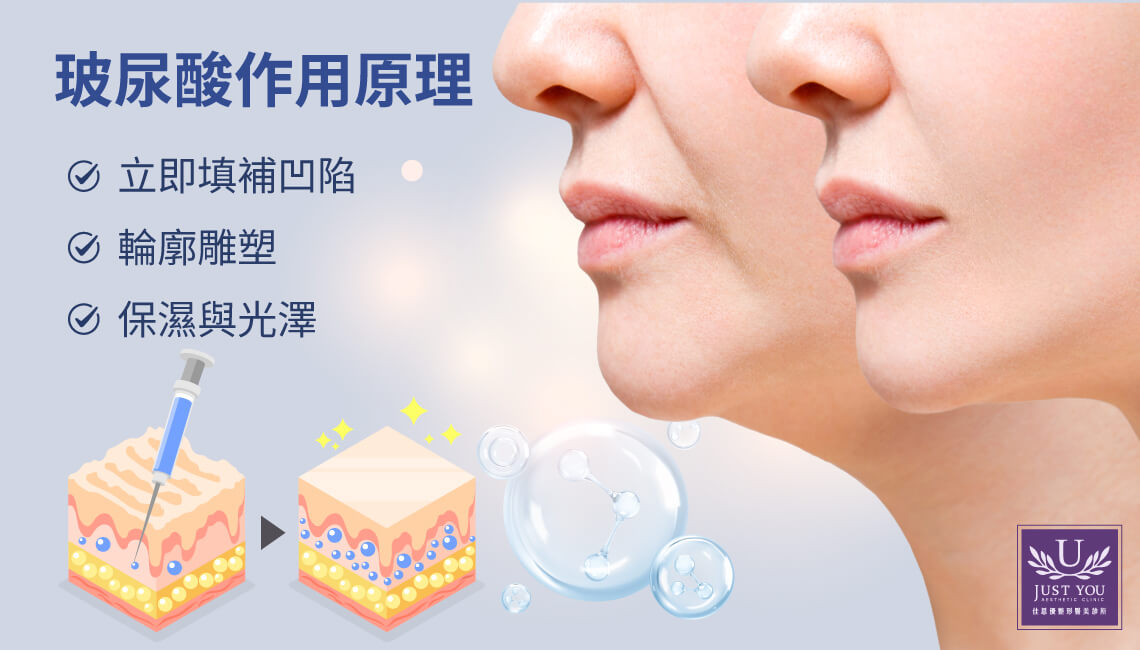 玻尿酸的作用原理:體積填補的科學