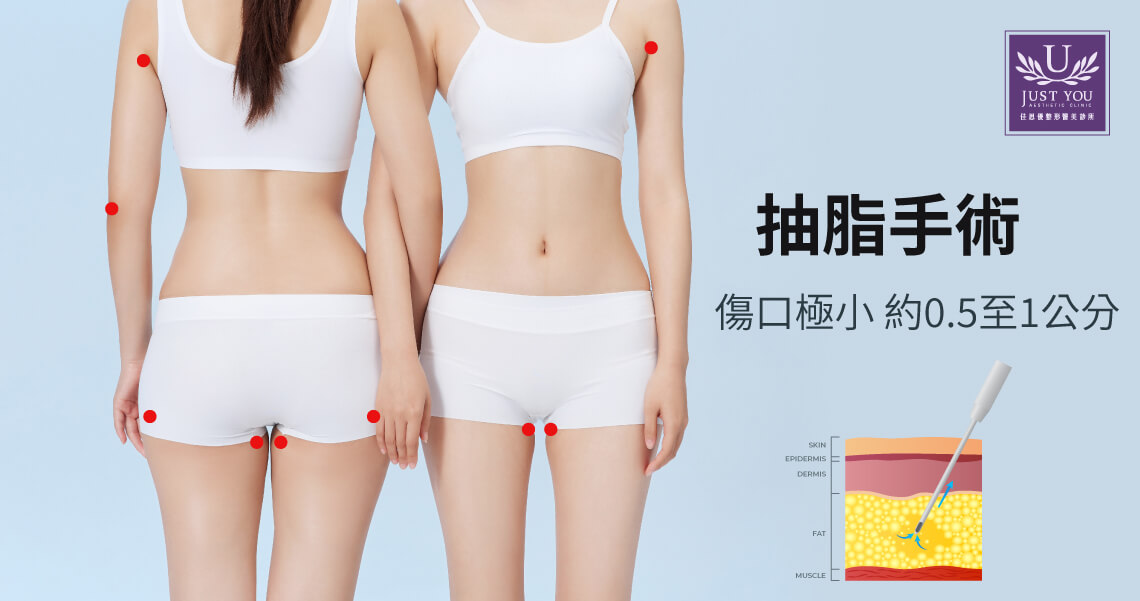 抽脂手術改善曲線
