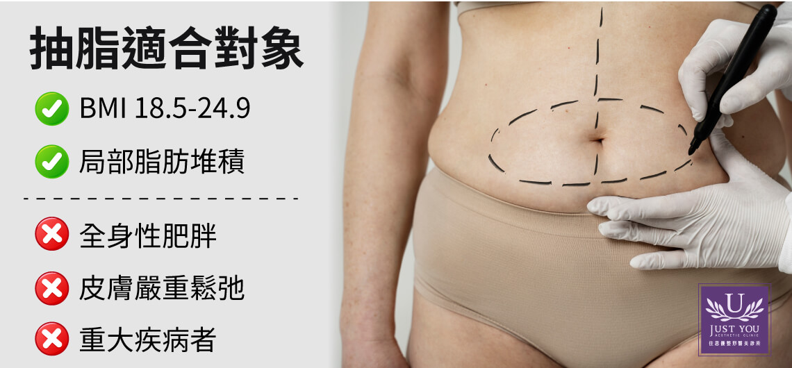抽脂手術適合對象