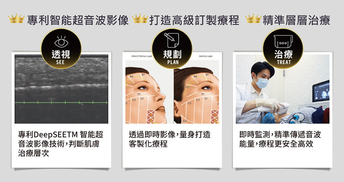 美國音波二代是透過專利的視覺成像系統，讓醫師能在螢幕上清楚看見皮下的結構，確保能量精準擊發在對的層次，並將能量聚焦在皮下 1.5mm、3.0mm 甚至 4.5mm 的 SMAS 筋膜層，產生熱凝結點（TCP）。這些凝結點會引發組織收縮，達到類似拉皮手術的懸吊拉提效果。