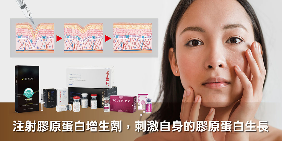 膠原蛋白增生劑（如4D舒顏萃Sculptra、洢蓮絲Ellans&eacute;、艾麗斯AestheFill、薇貝拉VIVABELLA）：重建流失的軟組織支撐力。這類針劑能刺激人體自身的膠原蛋白生長。不僅是填補凹陷，更是重建皮膚內部的骨架與密度。提供臉頰凹陷、太陽穴凹陷更自然、更長效的支撐，讓皮膚恢復厚實感與彈性。