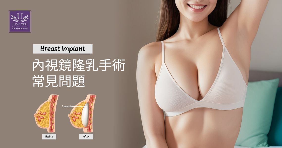內視鏡隆乳手術常見的問題