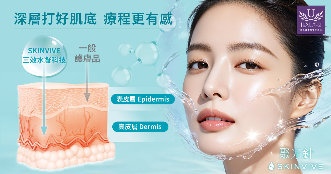 喬雅登SKINVIVE聚光針調配採用專利V鏈結技術，以90％低分子玻尿酸混合10％高分子玻尿酸，使玻尿酸鏈產生高效交聯作用。