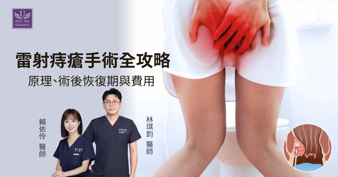 LHP新型微創雷射痔瘡消融