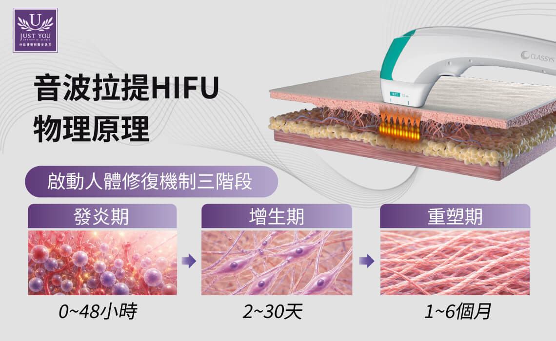 海芙音波的核心技術為高強度聚焦超音波 HIFU (High-Intensity Focused Ultrasound)。這項技術有別於雷射或脈衝光等光電設備，超音波具備組織穿透力，能夠在不破壞表皮屏障的前提下，將熱能精準傳遞至指定的皮下深度，並在治療部位啟動人體的傷口癒合級聯反應